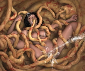 huevo Colocación de en el womb..